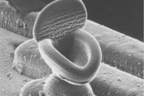 失效分析之电子篇:扫描电子显微镜分析